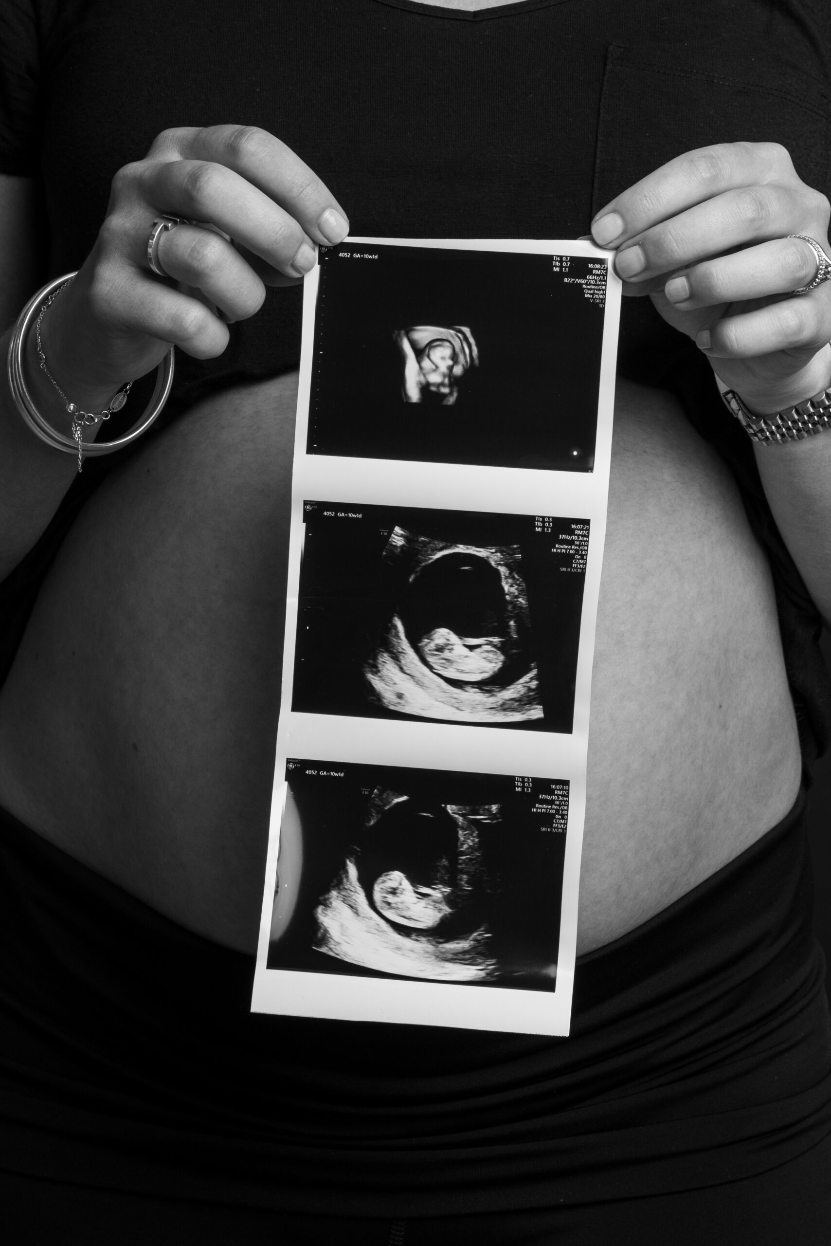 Maternity Fotoshooting Fotostudio Wetzikon